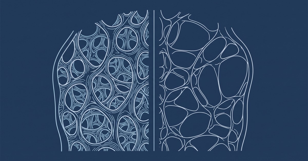 Ilustração editorial sóbria em tons de azul-marinho mostrando, em corte conceitual, a arquitetura interna de um osso: à esquerda a trama densa e bem conectada, à direita a mesma trama rarefeita, com as traves mais finas e espaçadas. Sem pessoas, sem radiografias reais e sem embalagens de medicamento.